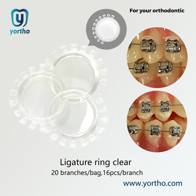 Orthodontic Ligature Ring Clear